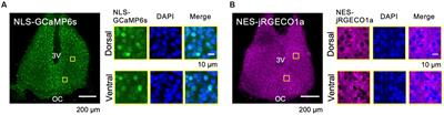 In-phasic cytosolic-nuclear Ca2+ rhythms in suprachiasmatic nucleus neurons